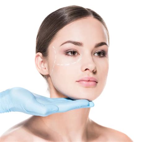 Finomszálas arcfiatalítás eredménye