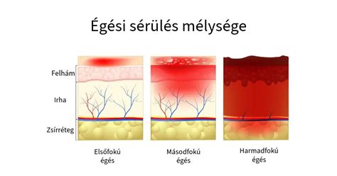 Futballisták sérülés közben