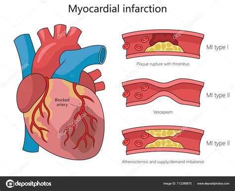 Különböző típusú zászlórudak