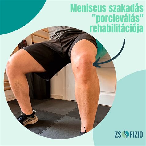 Jégpakolás térd sérülésre