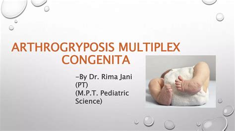 Arthrogryposis multiplex congenita végtag deformitásai