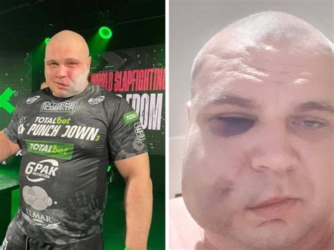 A lengyel pofozógép, David Zalewski komoly árat fizetett a győzelemért