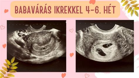 babavárás és névválasztás