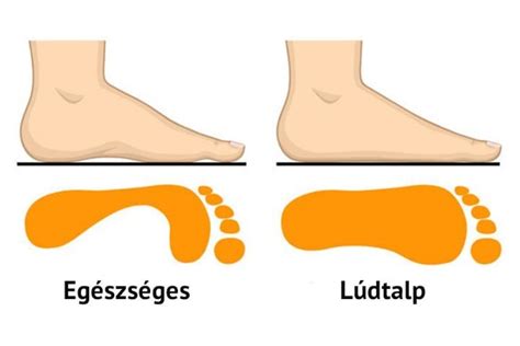 focicipő talp típusok összehasonlítása