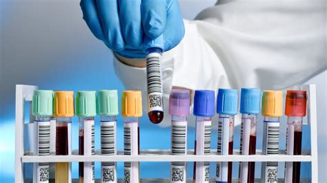 Laboratóriumi vizsgálatok gyermek sportolóknál
