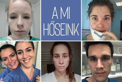 Orvosi karantén egy kézilabdázónak