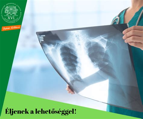 Tüdőszűrési vizsgálat