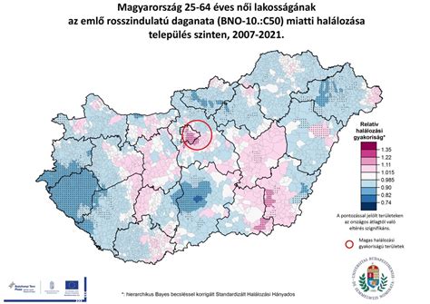 Az emlőrák stádiumainak szemléltetése