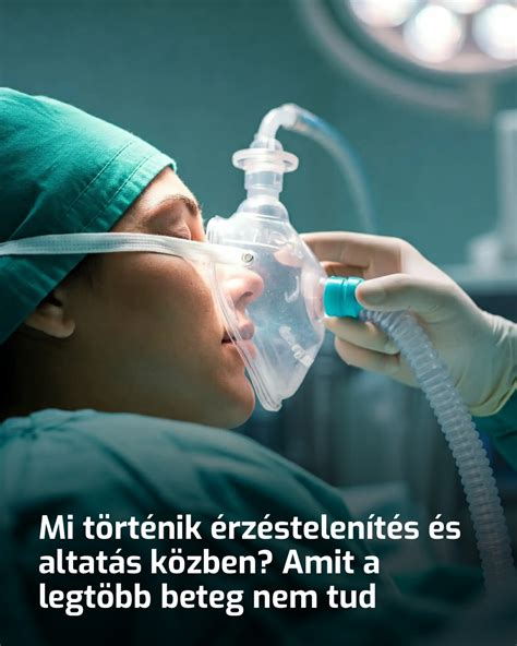 A selejtező útvonal sematikus ábrája