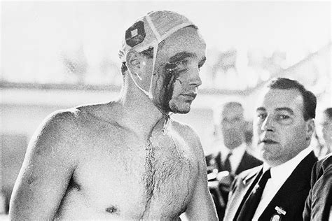 Zádor Ervin vérző arccal